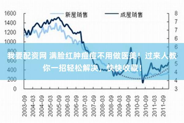 我要配资网 满脸红肿痘痘不用做医美！过来人教你一招轻松解决，快快收藏！